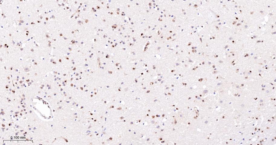 抑凋亡基因bag1重组兔单抗