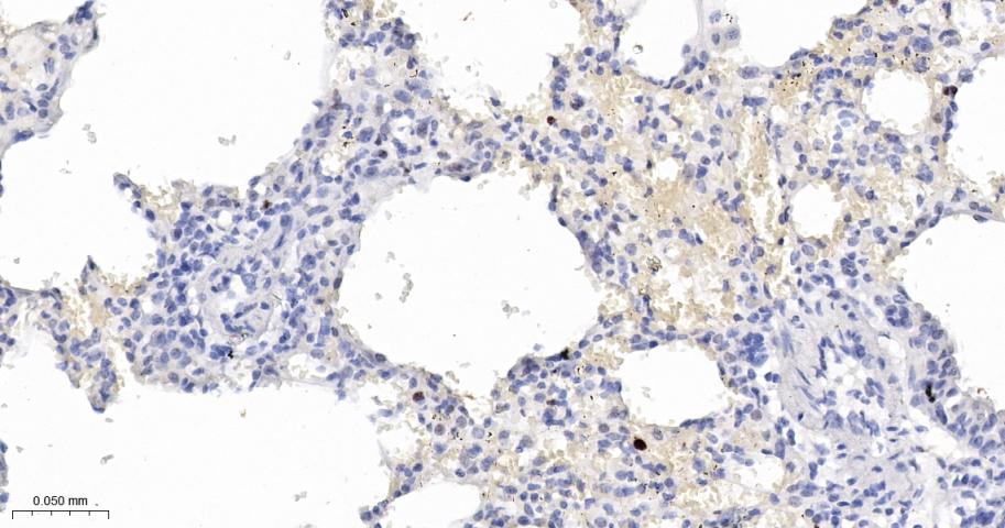 p21蛋白重组兔单抗