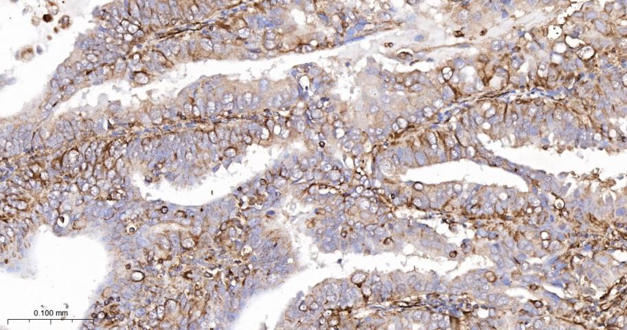 花生四烯酸15脂氧合酶1重组兔单抗-bsm-60930R