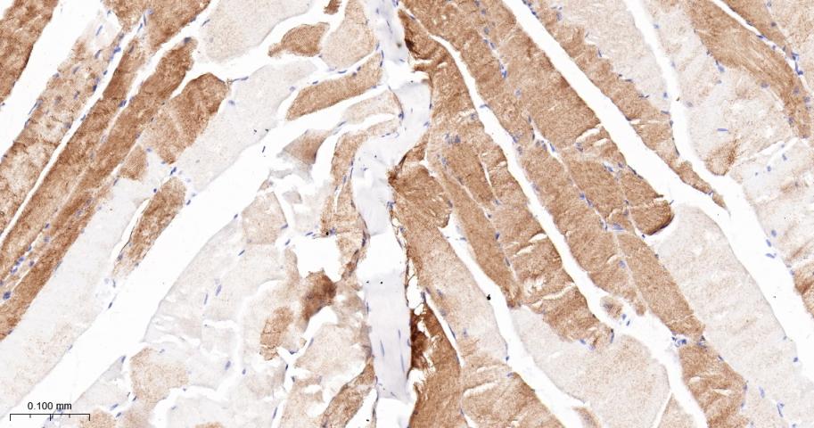 α横纹肌辅肌动蛋白重组兔单克隆抗体