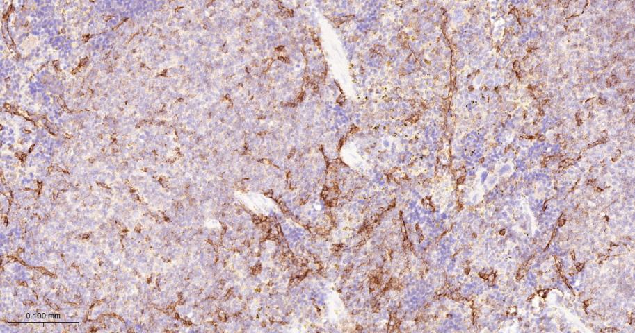 细胞间粘附分子-2（CD102）重组兔单抗