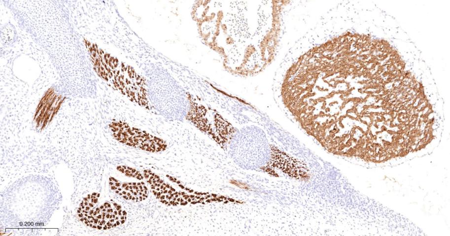 α横纹肌辅肌动蛋白重组兔单克隆抗体