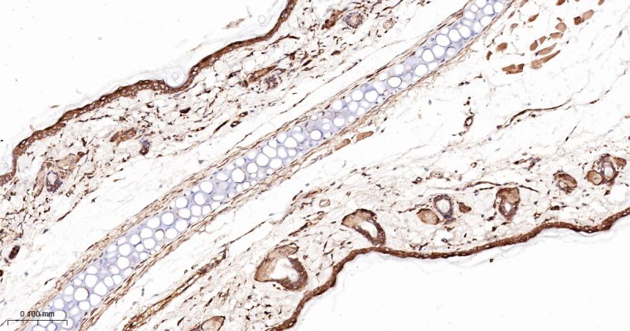 前列腺素氧化环化酶1重组兔单抗