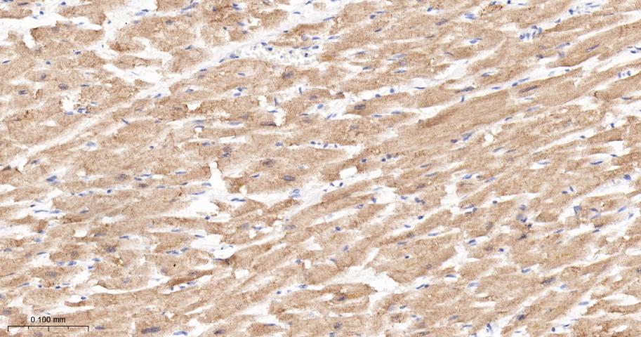 α横纹肌辅肌动蛋白重组兔单克隆抗体