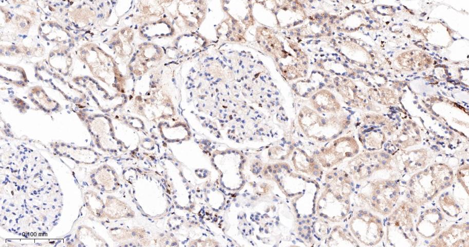前列腺素氧化环化酶1重组兔单抗