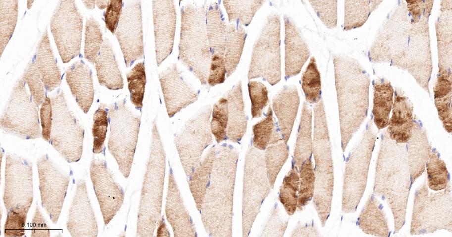 α横纹肌辅肌动蛋白重组兔单克隆抗体