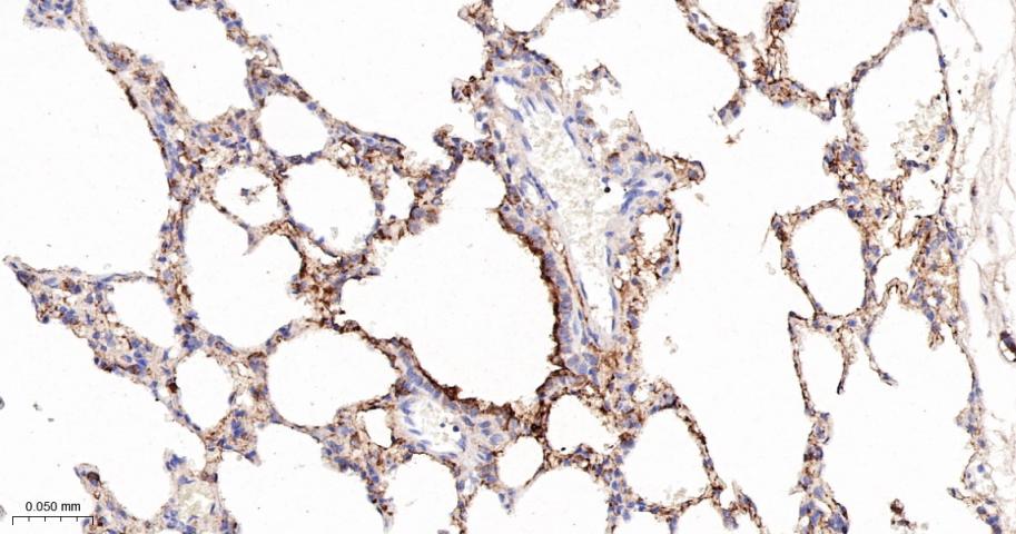 四连接素TN重组兔单抗