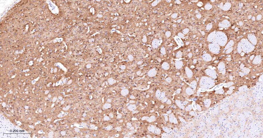 α横纹肌辅肌动蛋白重组兔单克隆抗体