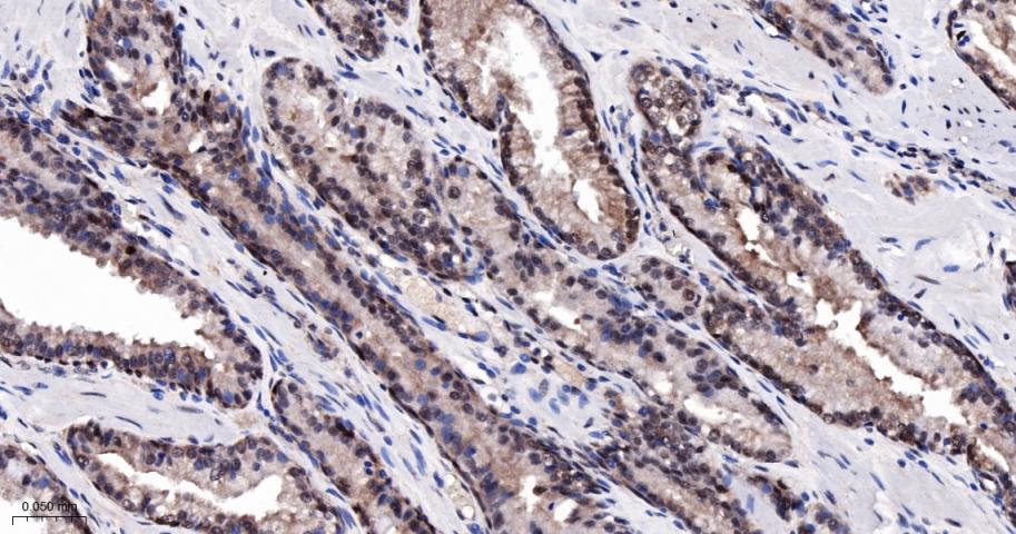 抑凋亡基因bag1重组兔单抗