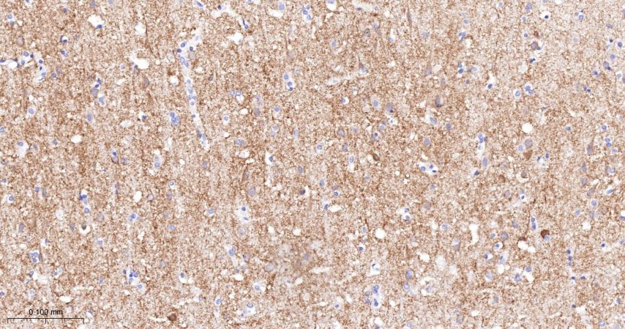 α横纹肌辅肌动蛋白重组兔单克隆抗体