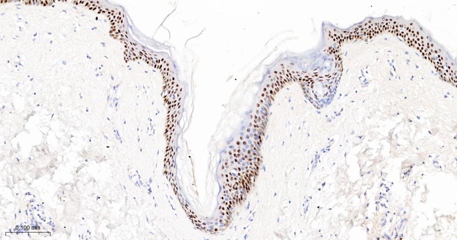 肿瘤抑制基因p63单克隆抗体