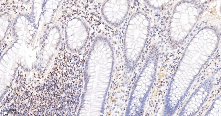 毛细血管扩张性共济失调症突变蛋白重组兔单抗