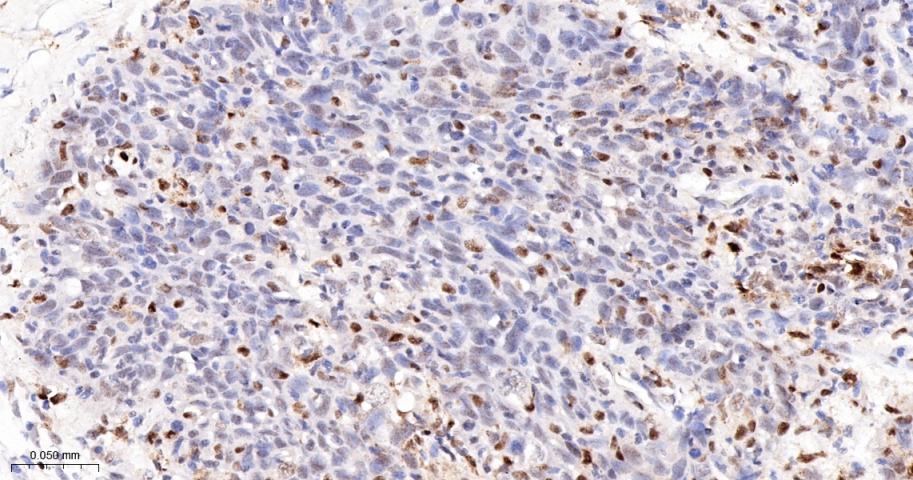 毛细血管扩张性共济失调症突变蛋白重组兔单抗