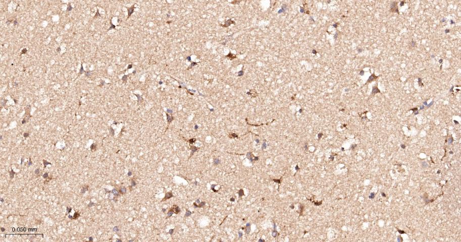 前列腺素氧化环化酶1重组兔单抗