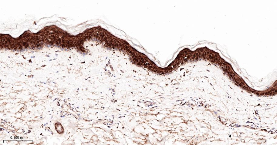 前列腺素氧化环化酶1重组兔单抗
