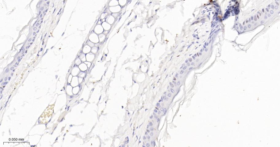 p21蛋白重组兔单抗