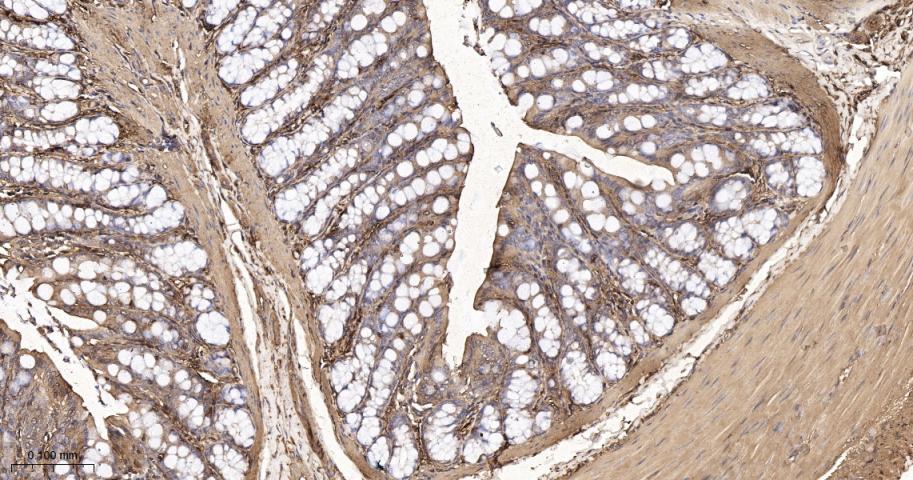 β-肌动蛋白（内参抗体）重组兔单抗
