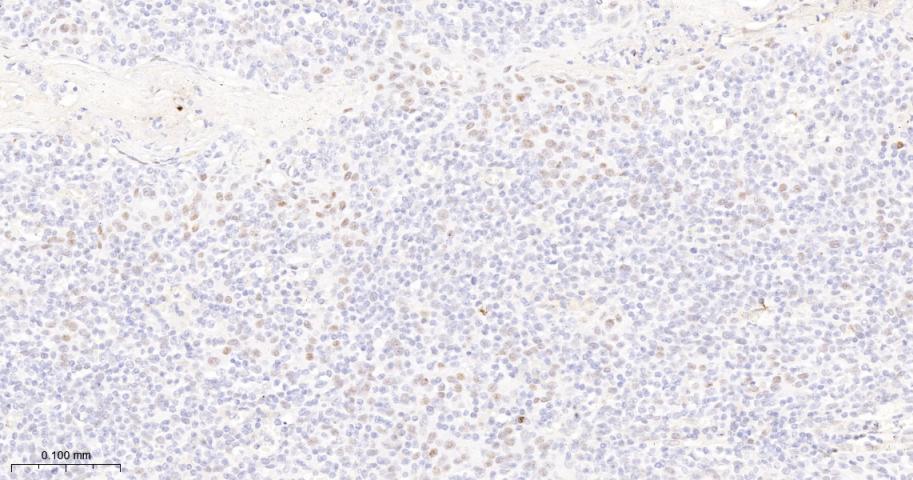 磷酸化ATM(Ser1981)重组兔单抗