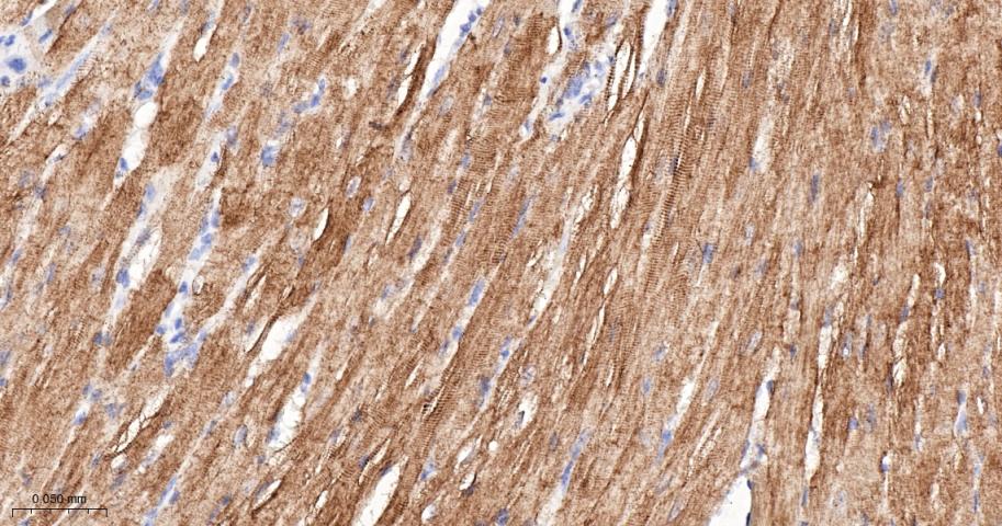 α横纹肌辅肌动蛋白重组兔单克隆抗体