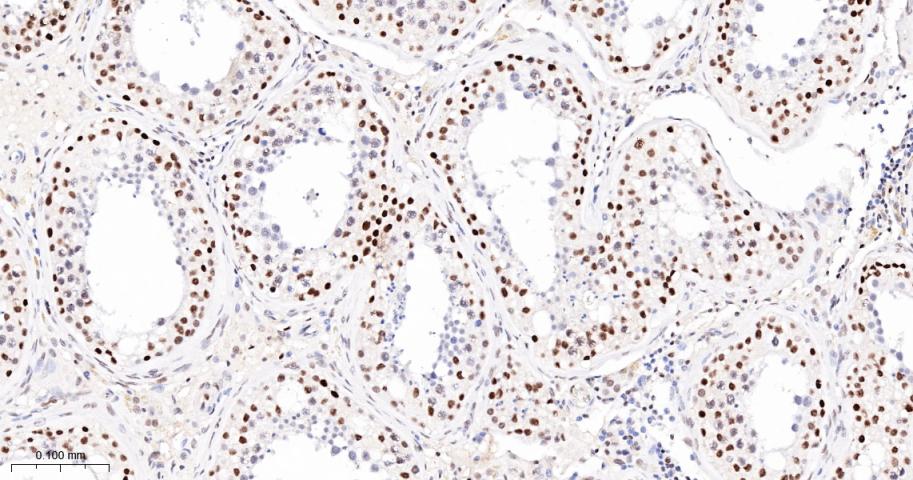 胚胎干细胞关键蛋白1重组兔单抗