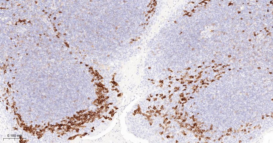 CD38单克隆抗体-bsm-43703M