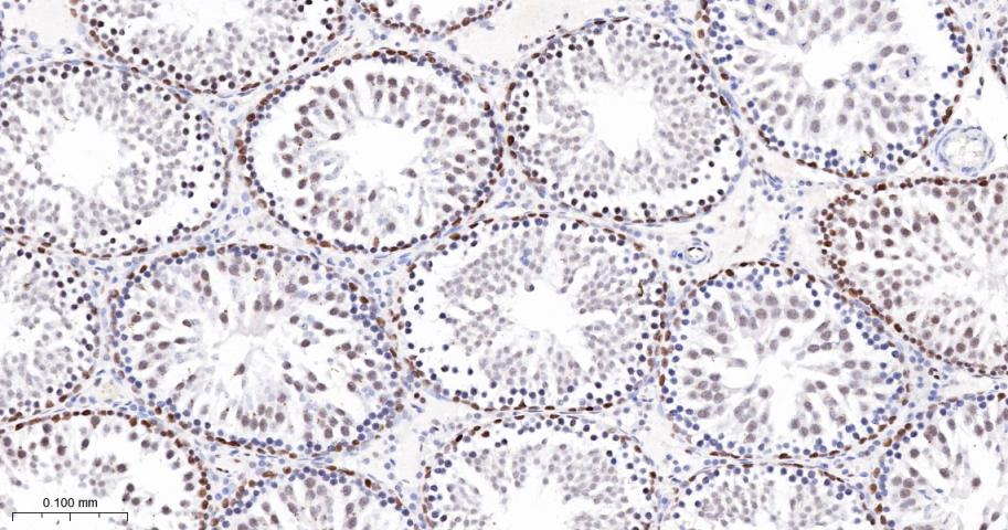 胚胎干细胞关键蛋白1重组兔单抗