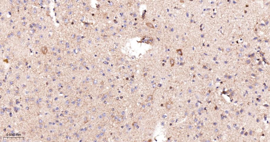 乙酰辅酶A羧化酶重组兔单抗