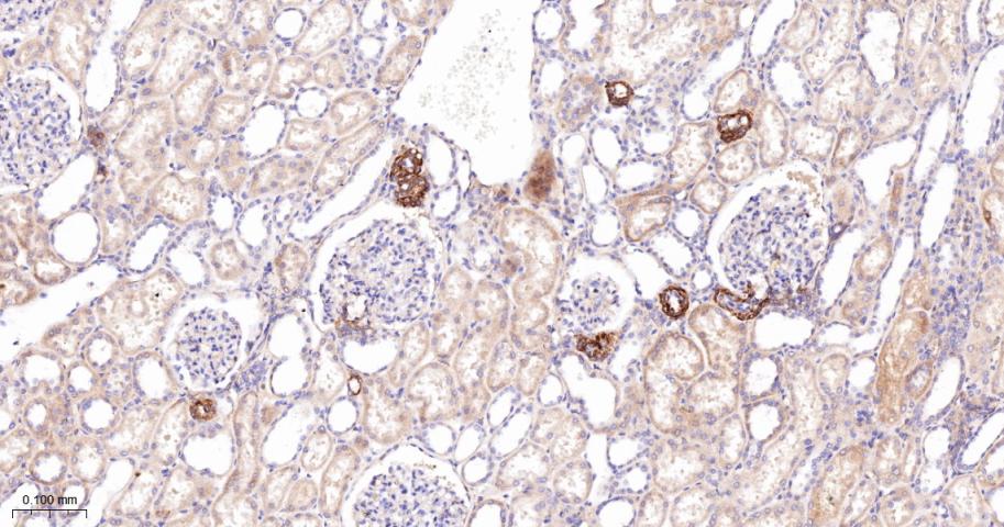 乙酰辅酶A羧化酶重组兔单抗