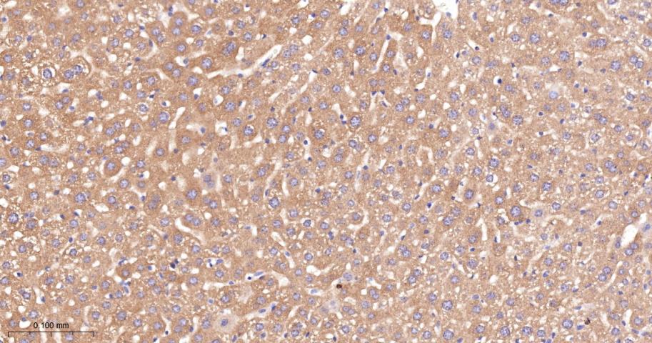 乙酰辅酶A羧化酶重组兔单抗