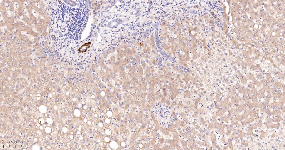 乙酰辅酶A羧化酶重组兔单抗
