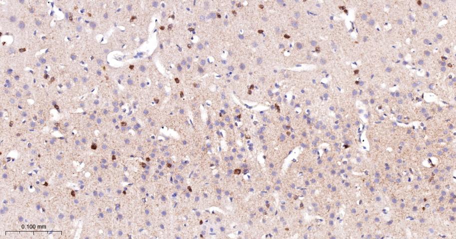 乙酰辅酶A羧化酶重组兔单抗