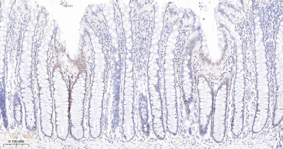 胚胎干细胞关键蛋白1重组兔单抗