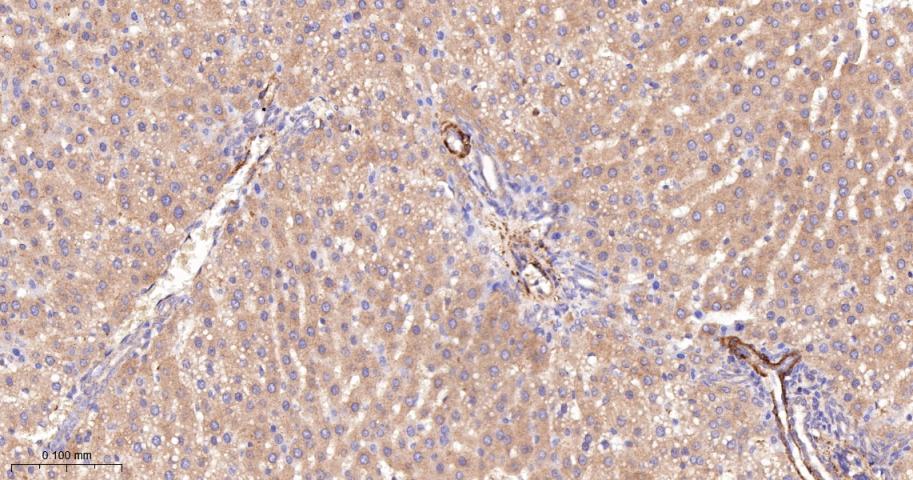 乙酰辅酶A羧化酶重组兔单抗