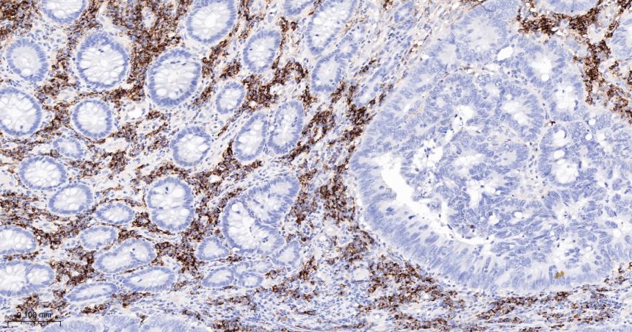 CD38单克隆抗体-bsm-43703M