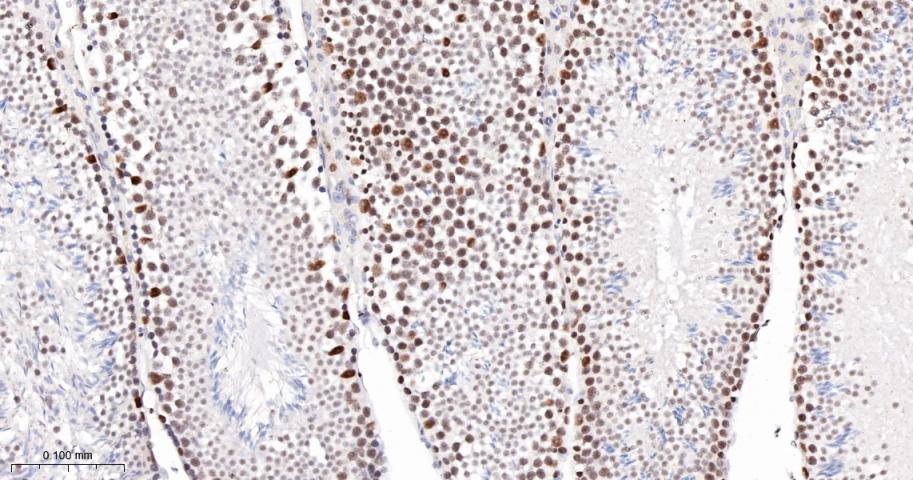 胚胎干细胞关键蛋白1重组兔单抗