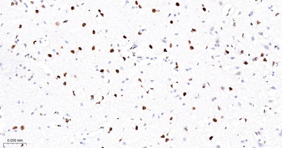 胚胎干细胞关键蛋白1重组兔单抗