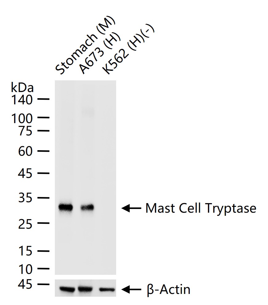 肥大细胞类胰蛋白酶重组兔单抗