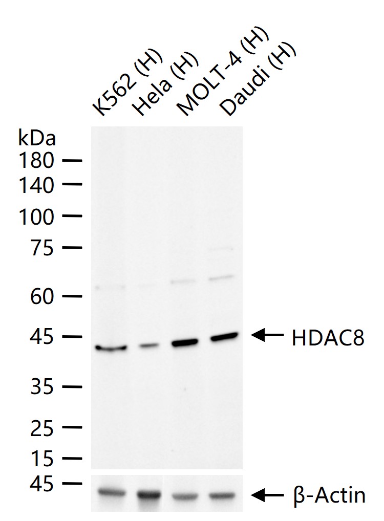 组蛋白去乙酰化酶8重组兔单抗