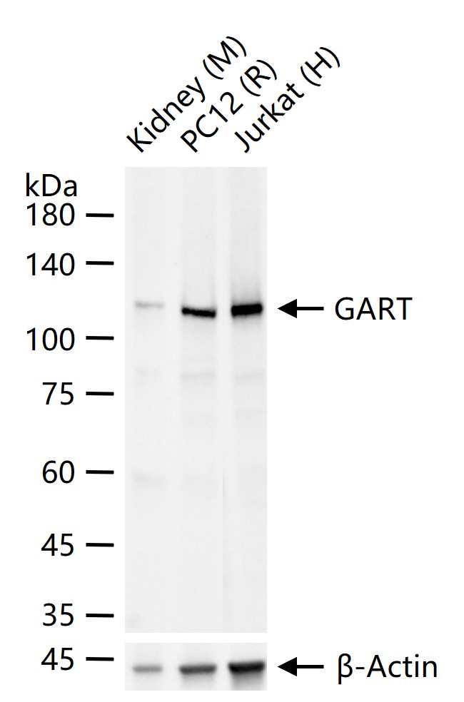 甘氨酰胺核苷酸合成酶重组兔单抗