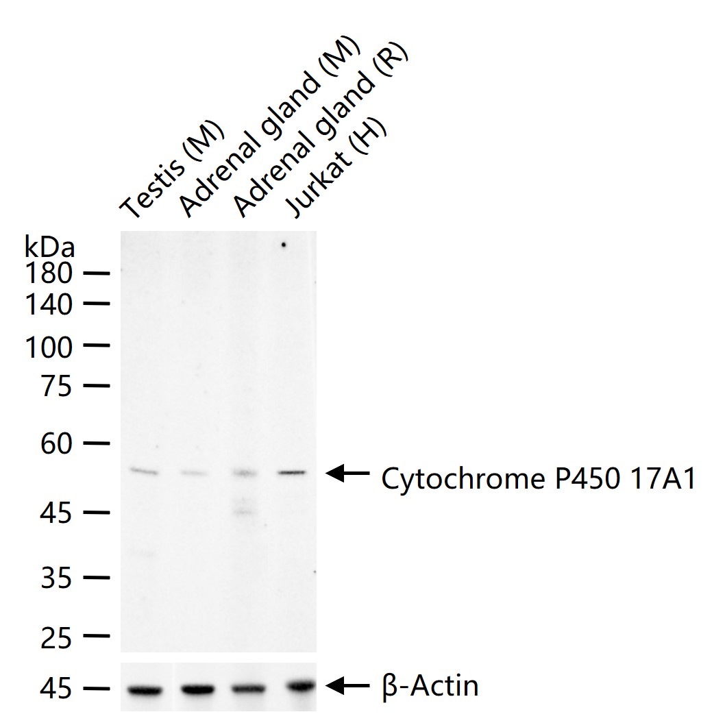 细胞色素P450 17A1重组兔单抗