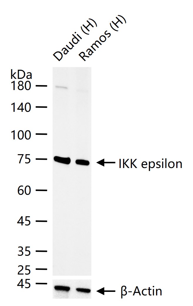 核因子κB抑制蛋白E重组兔单抗