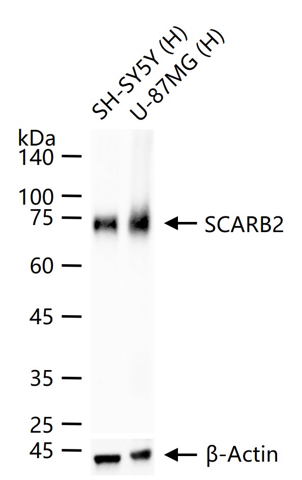 清道夫受体B2重组兔单抗
