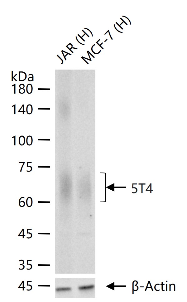 滋养层细胞糖蛋白5T4重组兔单抗