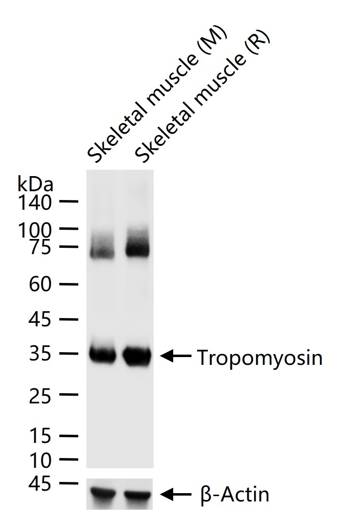 原肌球蛋白1重组兔单抗