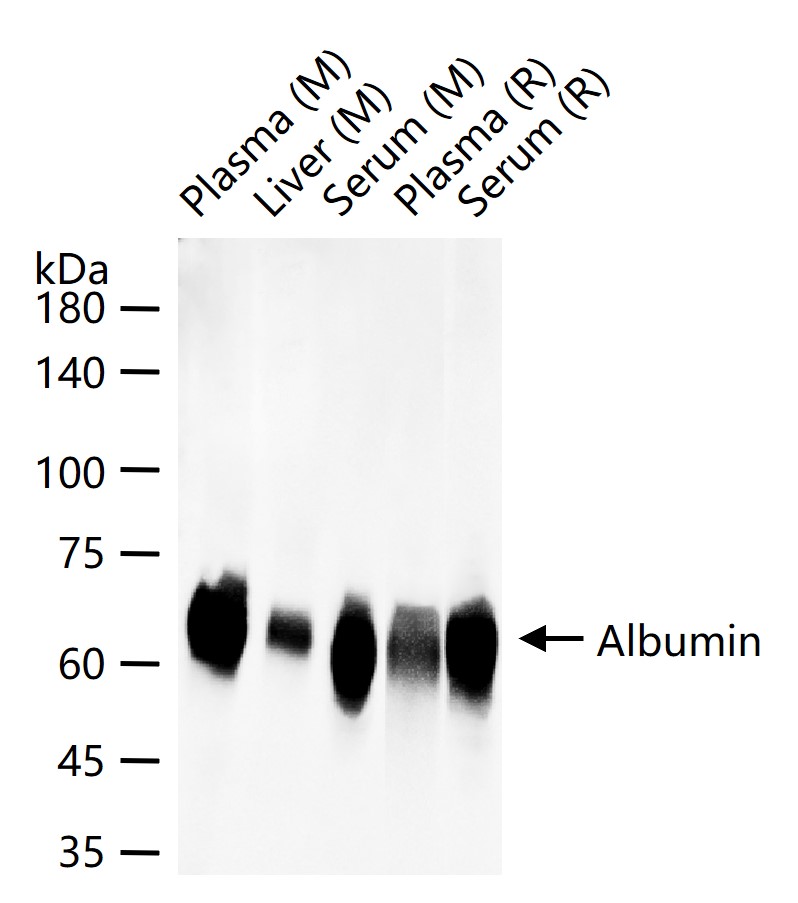 白蛋白重组兔单抗