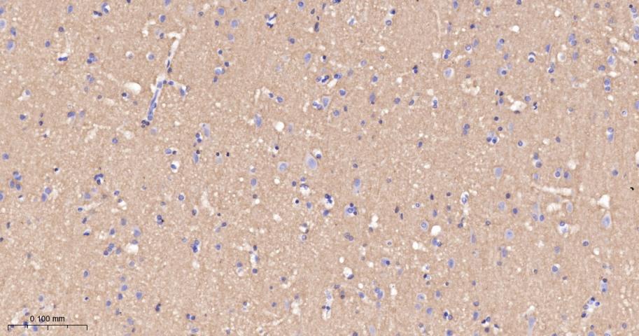 神经细胞粘附分子配体1重组兔单抗