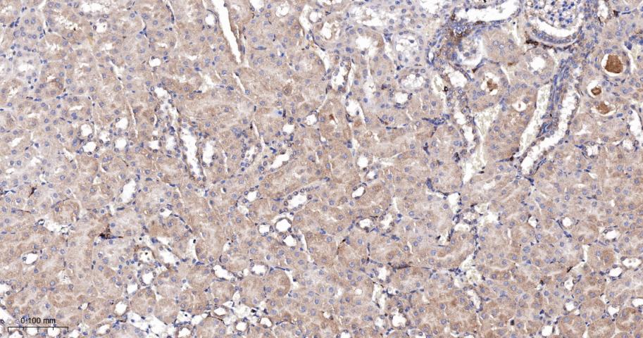 泛素结合蛋白P62重组兔单抗