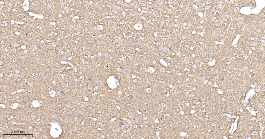 突触小泡蛋白P38重组兔单抗