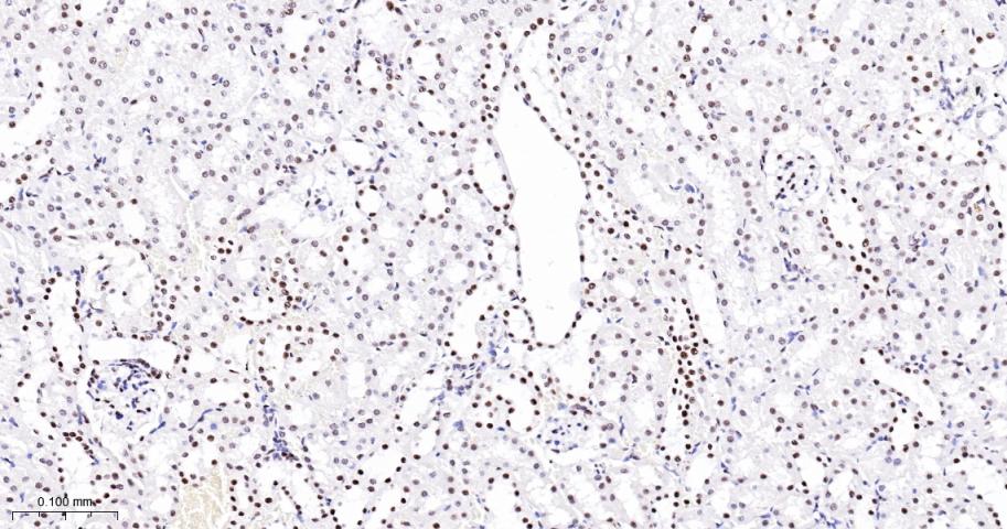 抑癌基因SNF2β重组兔单抗