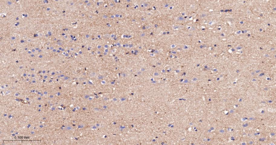 整合素αV（CD51）重组兔单抗